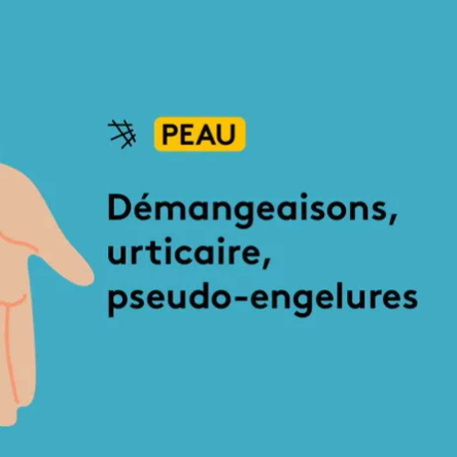 Les effets du "Covid long" sur la peau (JESSICA KOMGUEN / FRANCEINFO)